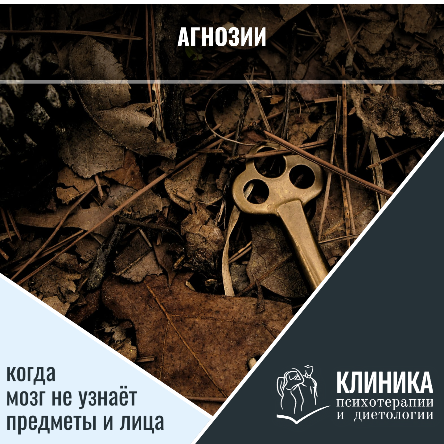 Агнозии: когда мозг не узнаёт предметы и лица