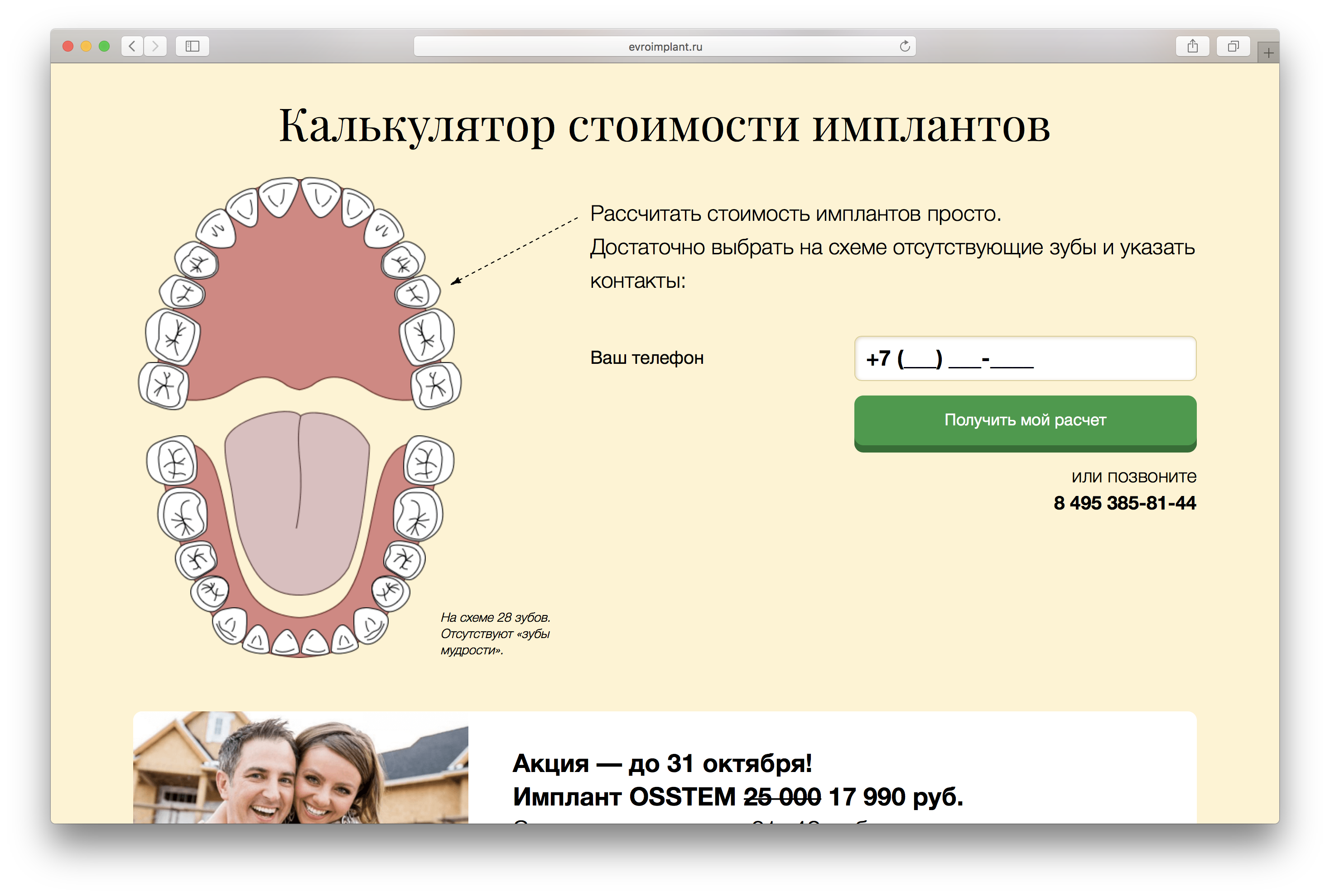 прейскурант имплантация зубов. этапы имплантации зубов. рассчитать имплантацию. одноэтапная имплантация. схема установки зубного имплантата.