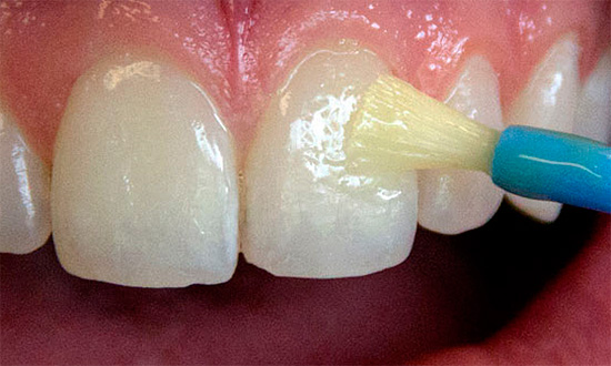 Повышенная чувствительность зубов: причины и лечение | Клиника Семейный доктор