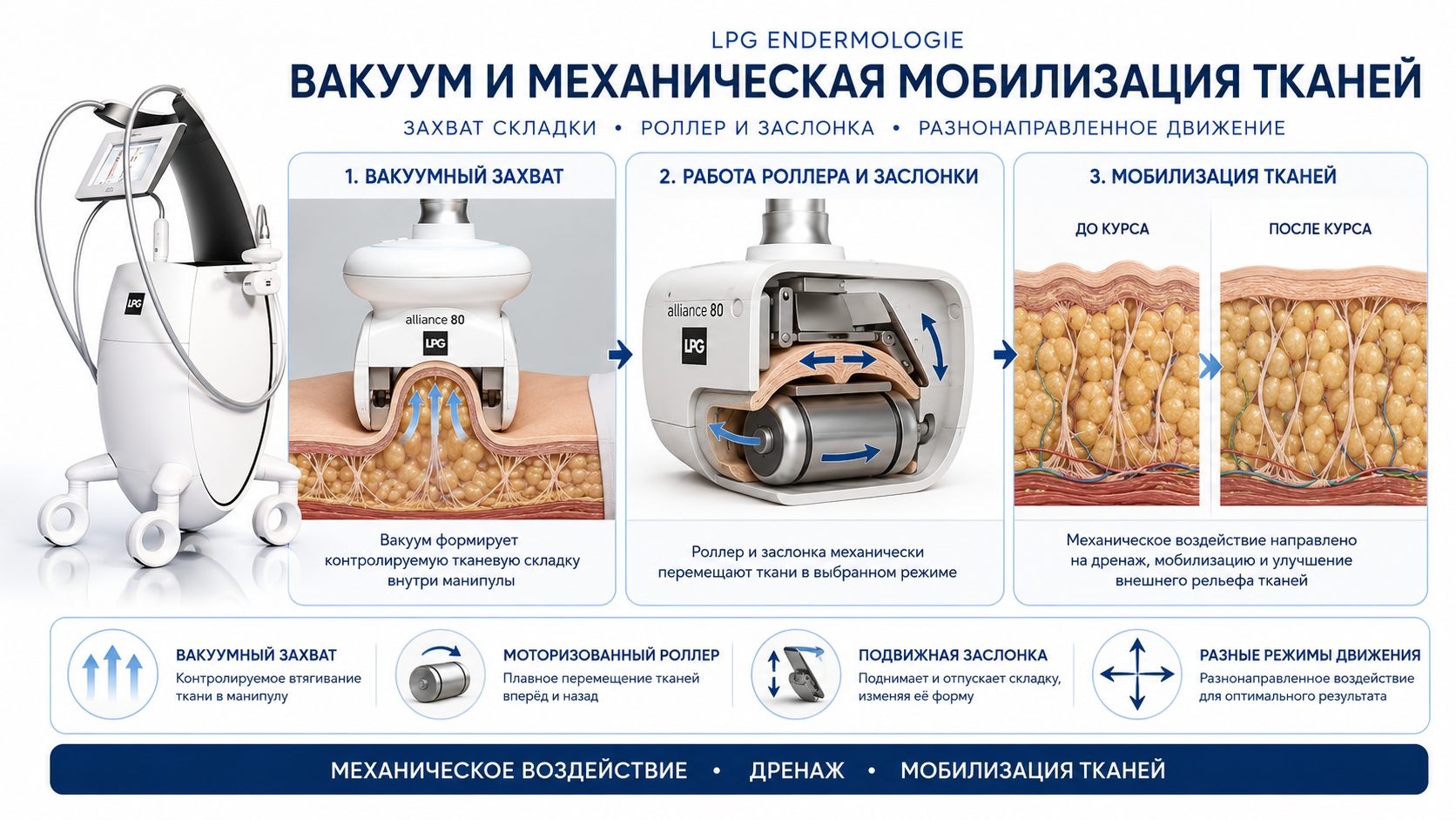 LPG Endermologie — схема вакуумного захвата и механической мобилизации тканей