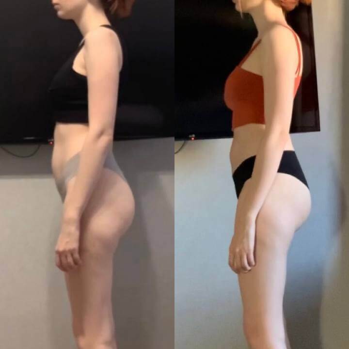 Диагностика осанки. Сорокина Юлия