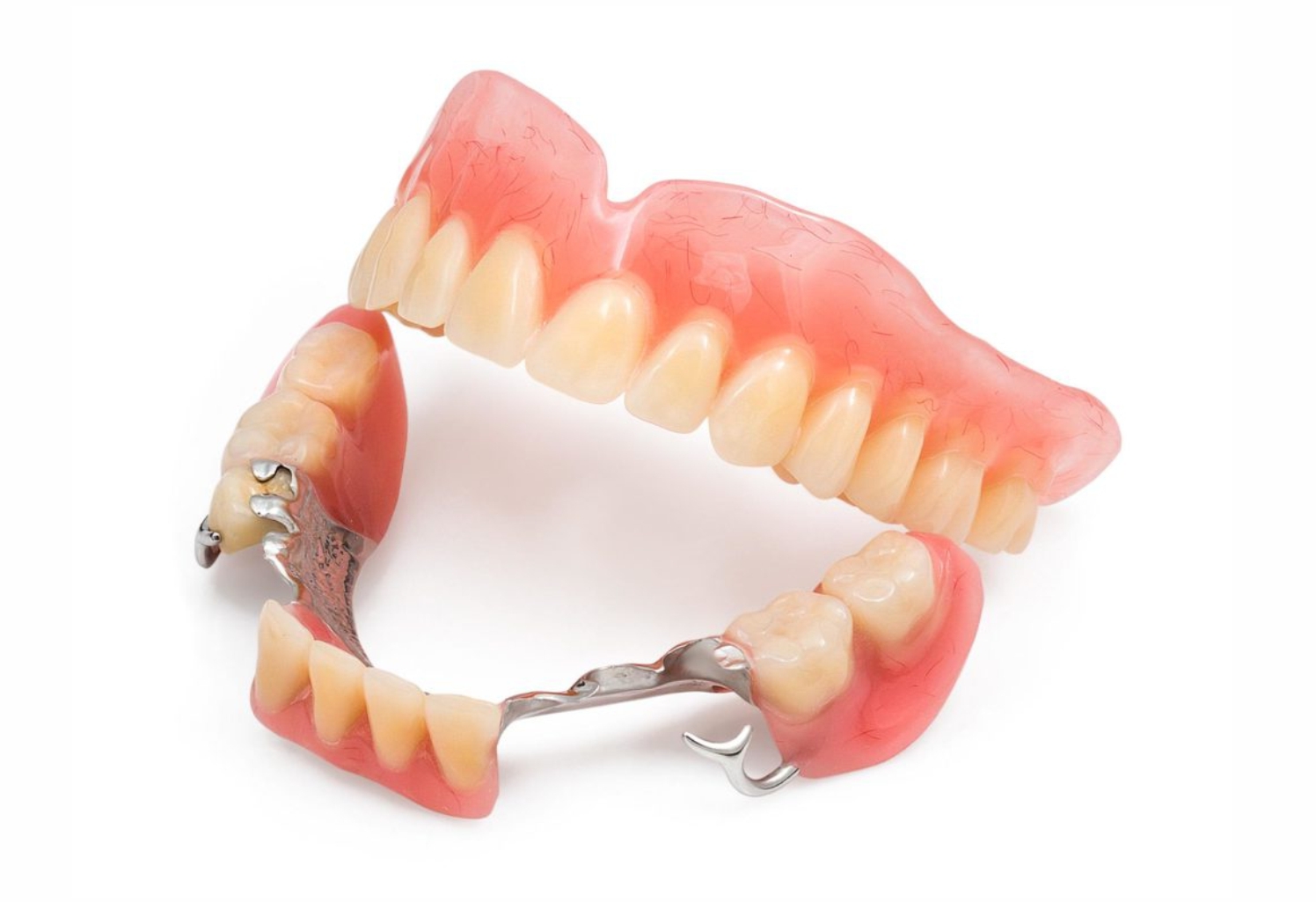 Съемный протез зубов какие бывают. Съемный бюгельный протез (1 челюсть). Бюгельный протез кламмерный (remanium-700). Бюгельный зубной протез. Бюгельный протез (1 челюсть)+кламмер.