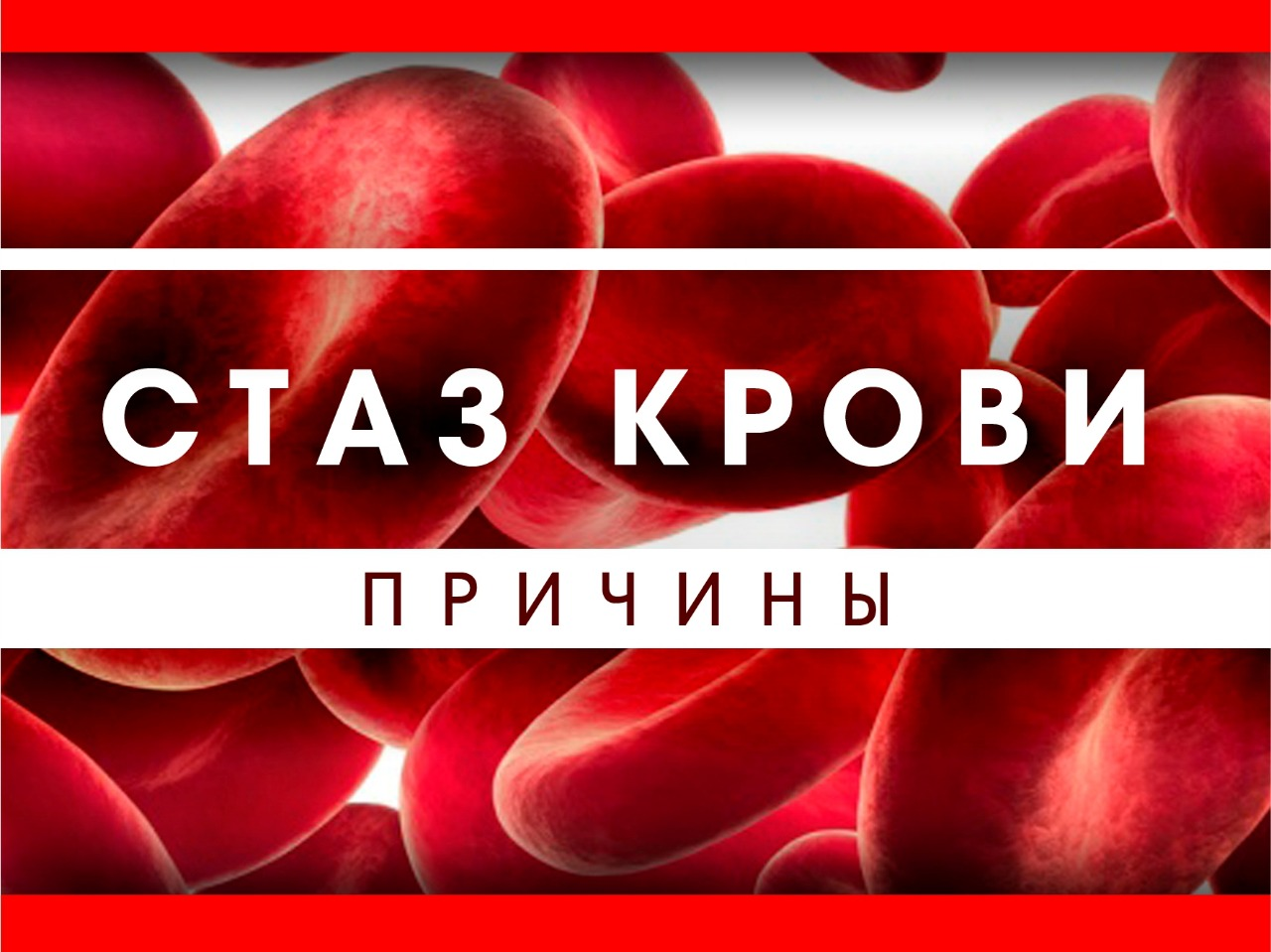 Стаз патофизиология.