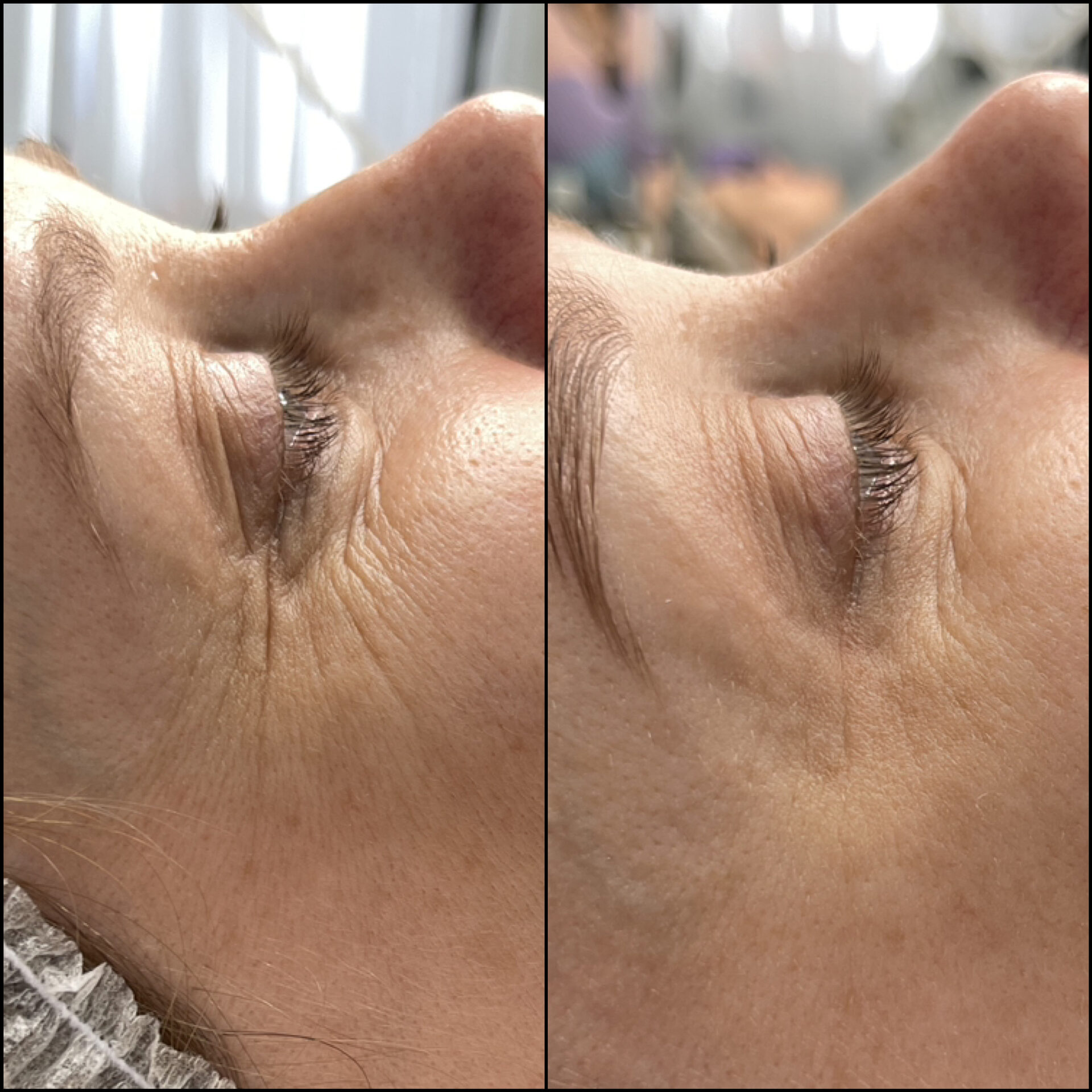 ДО/ПОСЛЕ ЭСТЕТИЧЕСКИХ ПРОЦЕДУР