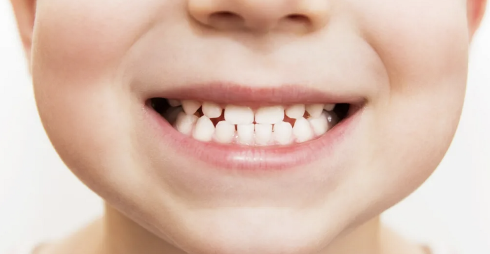 лечение прикуса в арзамасе