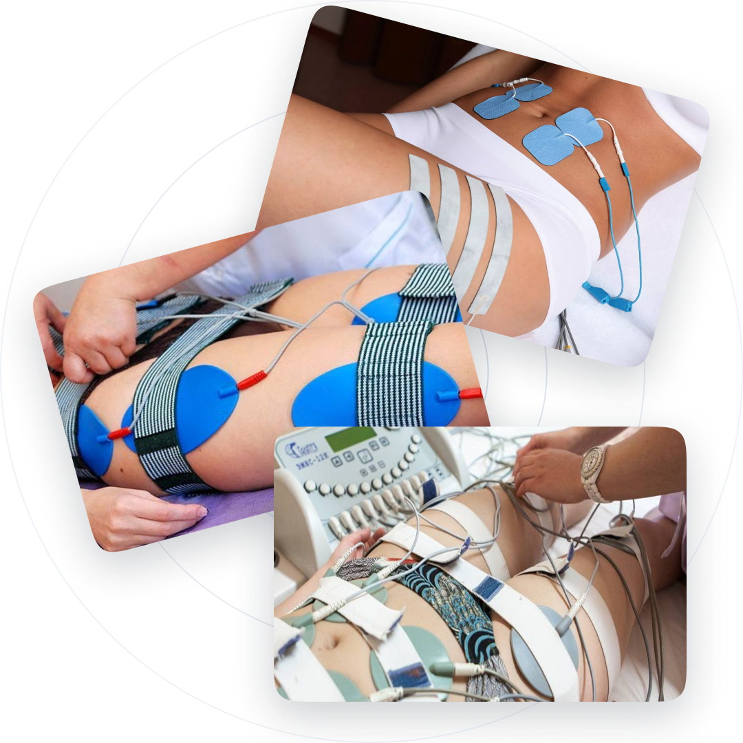 электростимуляция в салехарде