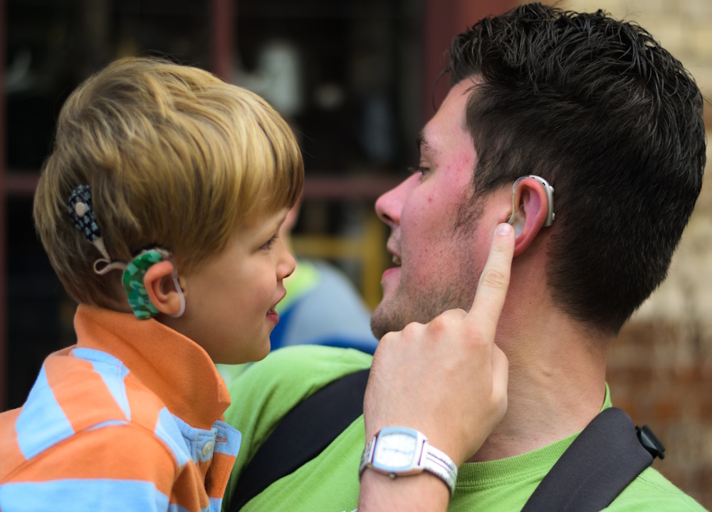 Слуховое восприятие слабослышащих. Кохлеарная имплантация. Кохлеарная имплантация что это такое у ребенка. Дети с кохлеарными имплантами.. Подросток со слуховым аппаратом.
