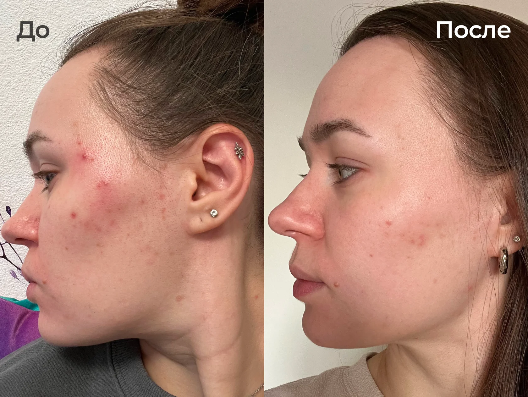 Светлана, 32 года