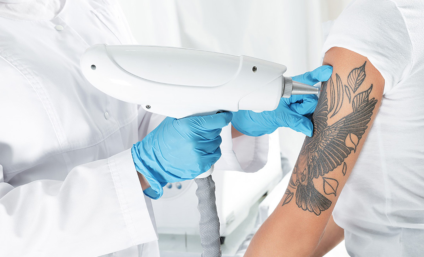 Можно ли делать лазерную эпиляцию на татуировке
