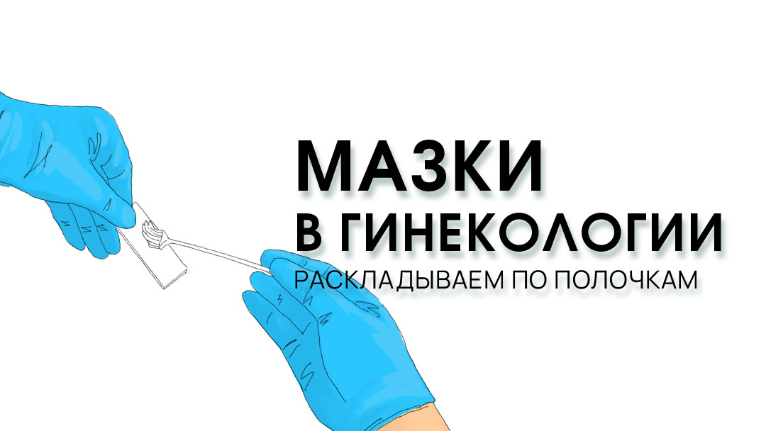 Цитологическое исследование мазка шейки матки в Нижнем Новгороде в клинике Тонус