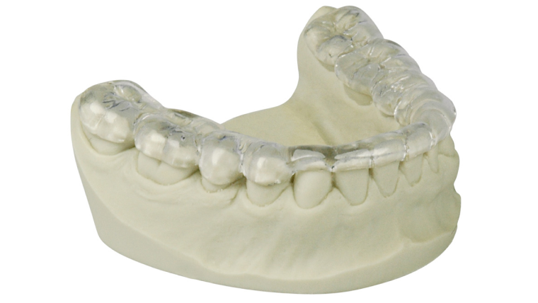 Сплинт-терапия в стоматологии: цены в Дербенте. Стоматология DK