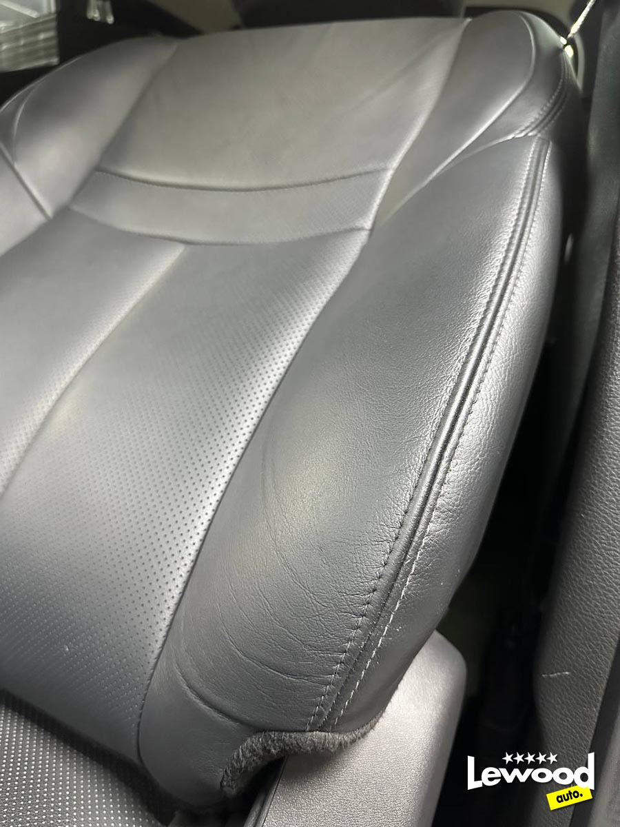 реставрация боковой поддержки