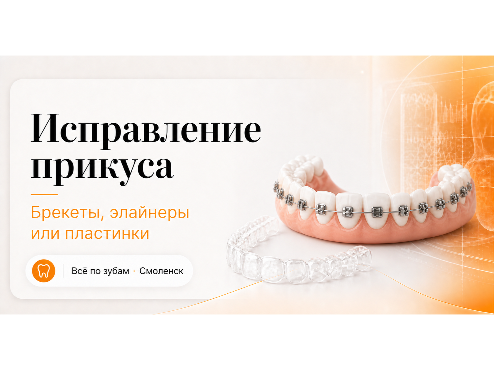 Исправление прикуса у детей и взрослых: брекеты, элайнеры и пластинки