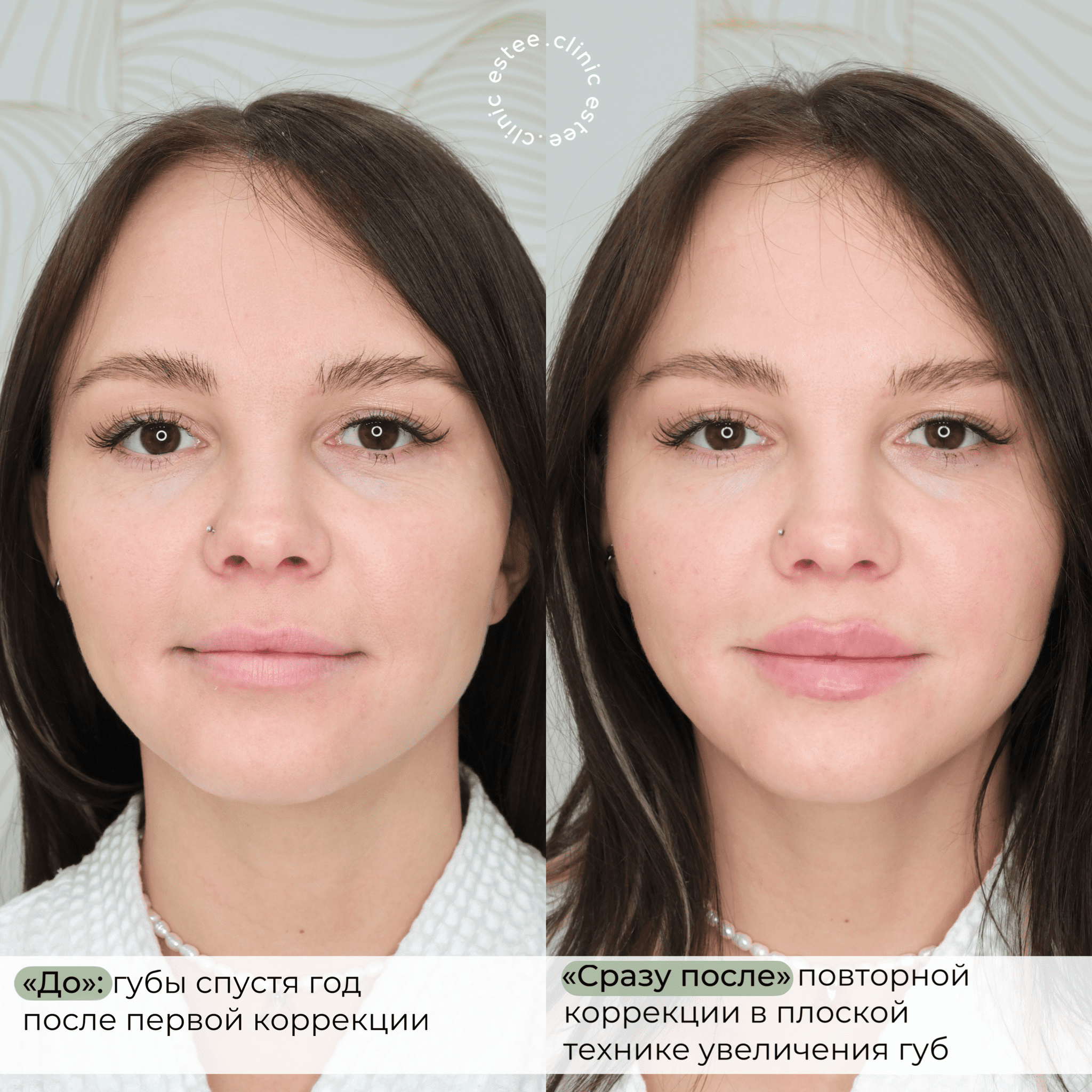 Estee clinic сургут