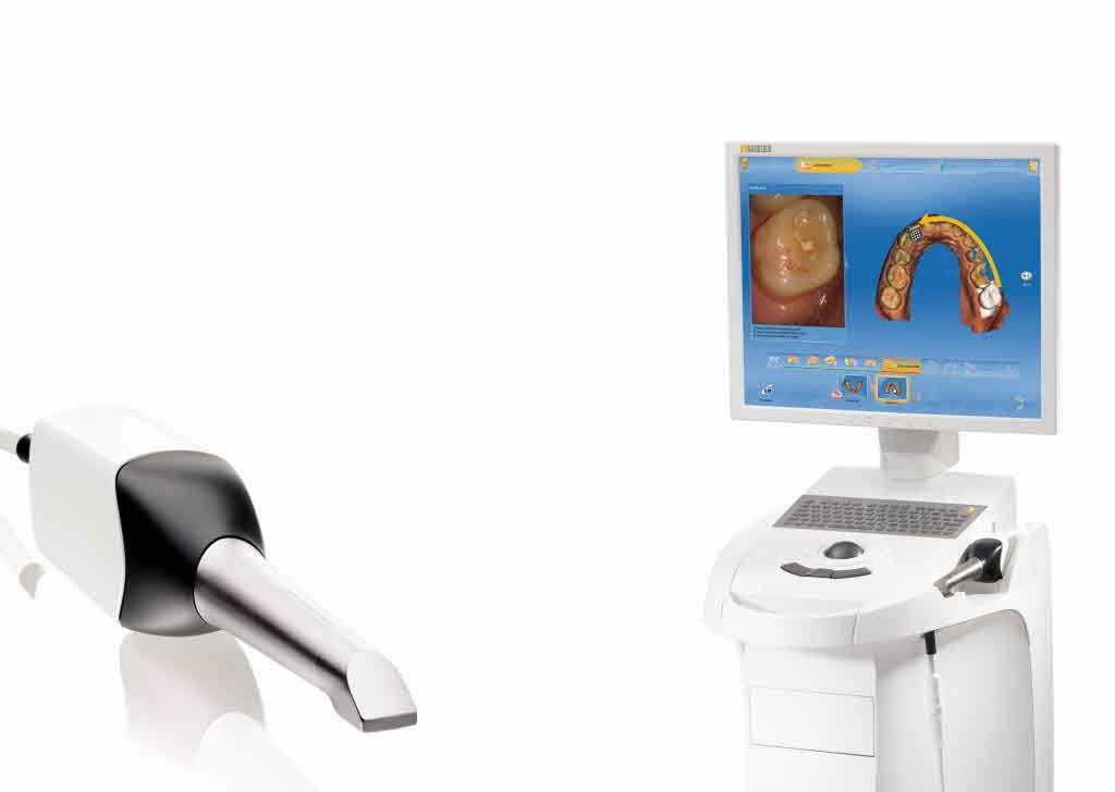 Реставрации зубов: технологии CEREC в стоматологии |СК КОМФОРТ-ДЕНТ ...