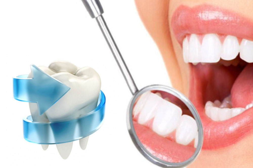 Реминерализующая терапия глубокое фторирование. Фторирование зубов эмали глубокое эмаль. Фторирование зубов фторлак. Глубокое фторирование эмали зуба (1 зуб).
