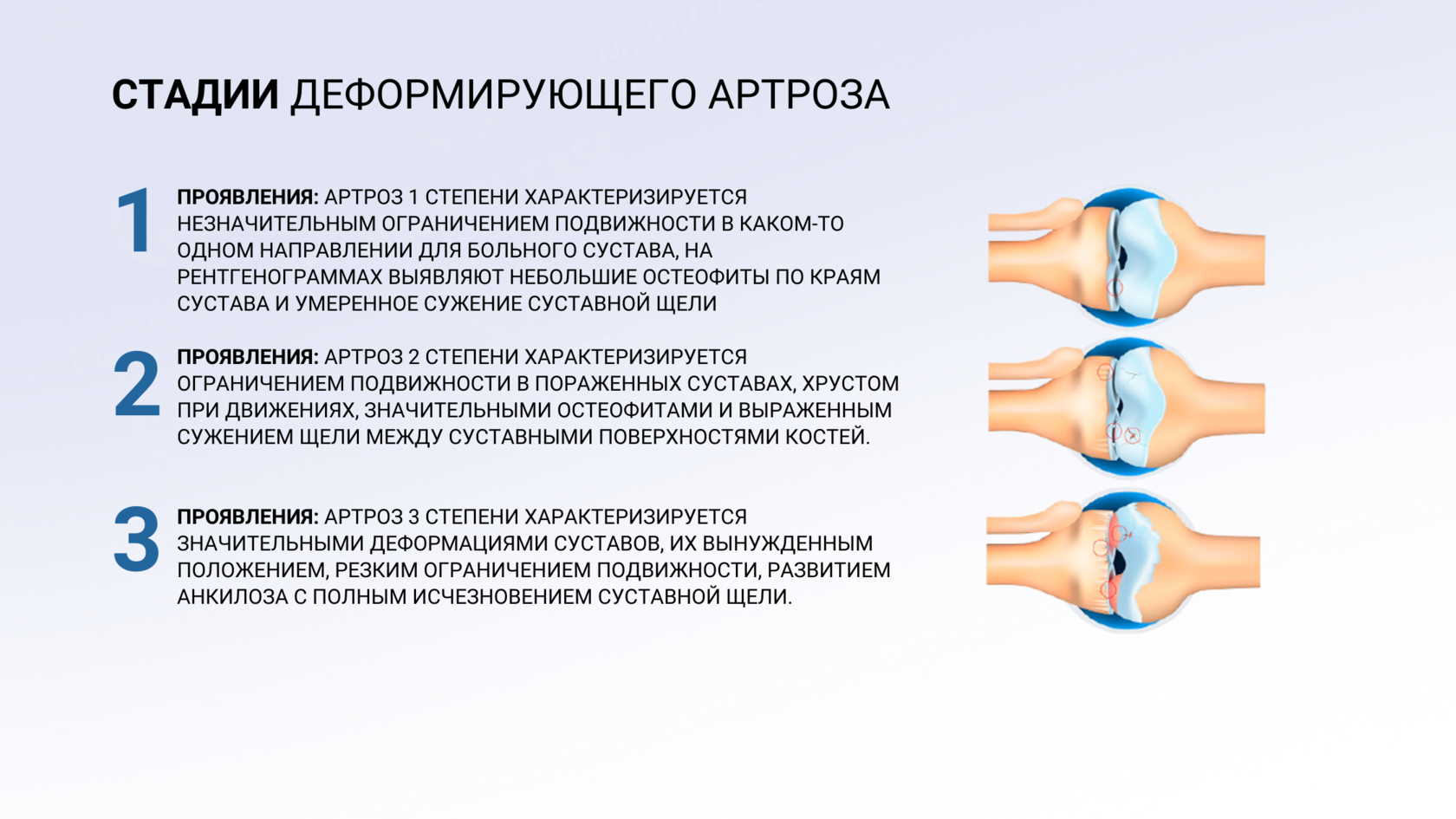 Коленный сустав по стадиям. Деформирующий артроз первого плюснефалангового сустава III стадии. Деформирующий артроз 2 стадии. Деформирующий артроз 1-2 степени. Гонартроз- деформирующий артроз коленного сустава.