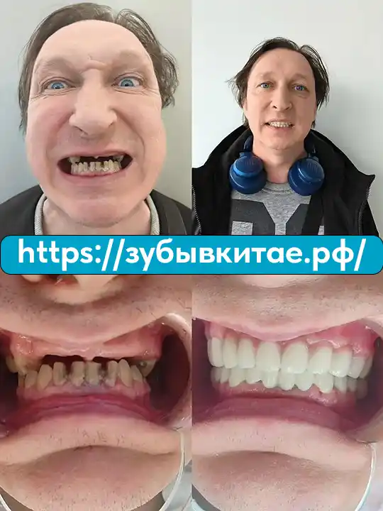 До и после — кейс 5