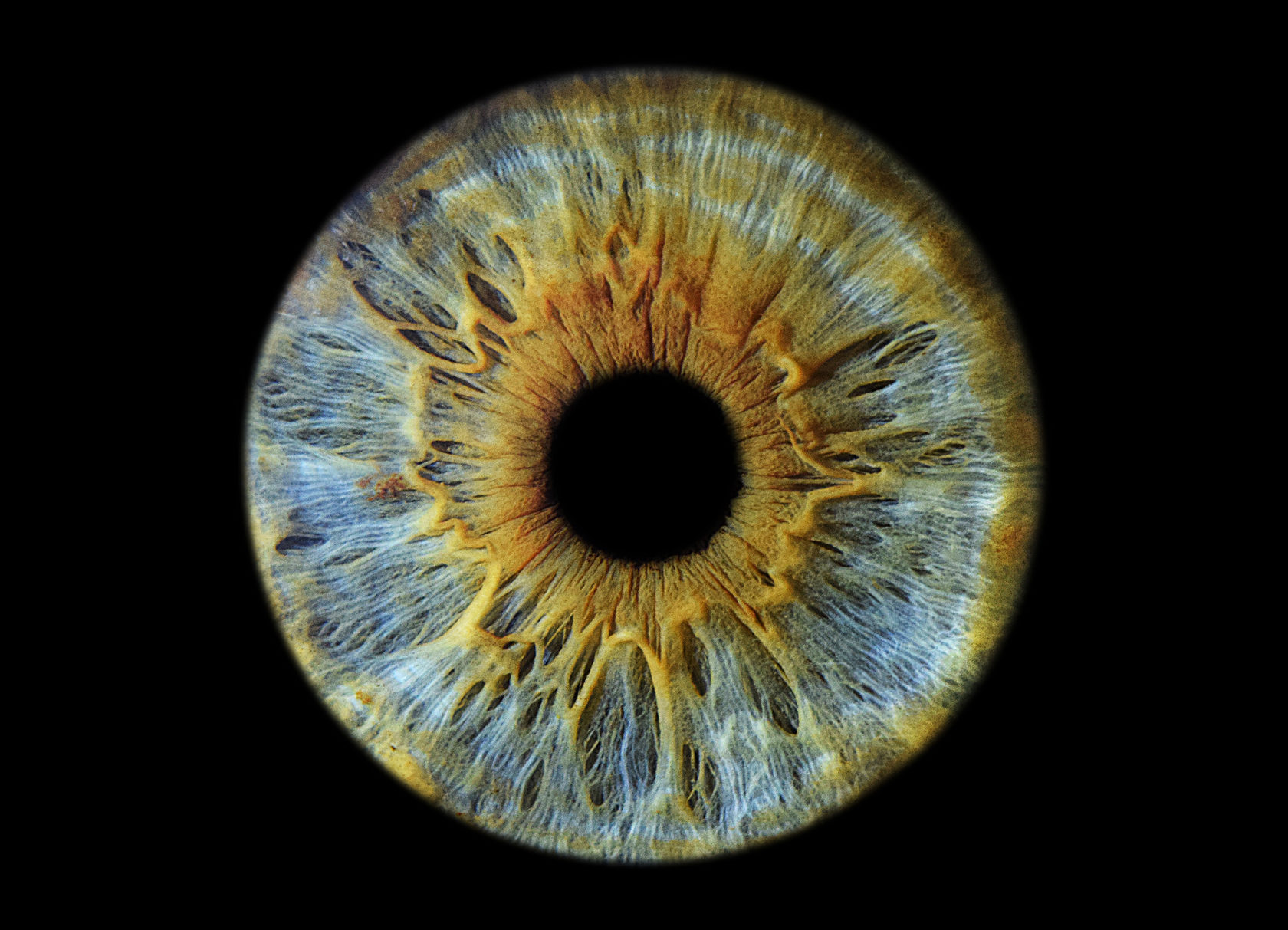 Фото радужки глаза чебоксары
