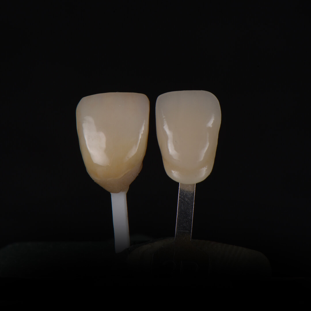 Зуботехническая лаборатория москва