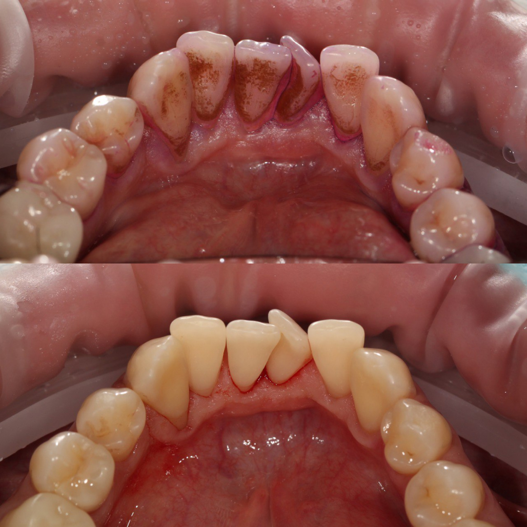 Санация полости рта: процедура, формы и справка