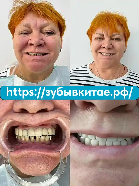 До и после — кейс 12