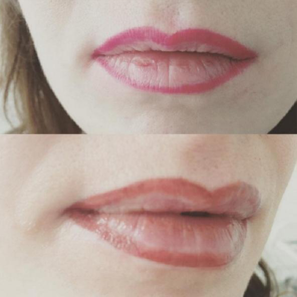 Контур губ до и после. Перманентный татуаж губ контур. Неудачный перманентный макияж губ. Контур губ перманентный макияж.