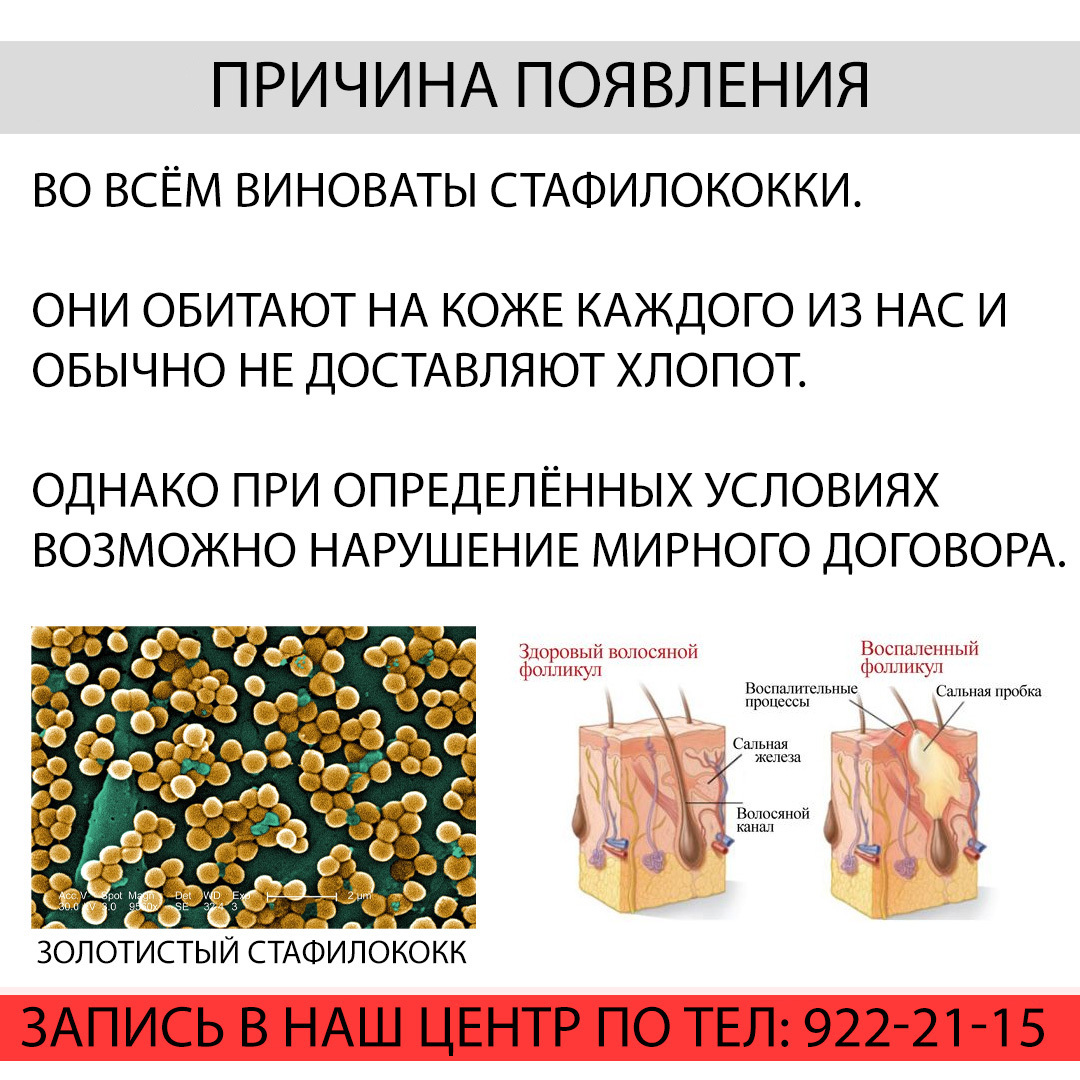 Чем отличается прыщ от фурункула фото