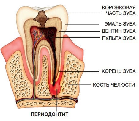 Лечение кариеса зубов в клинике доктора Барышева