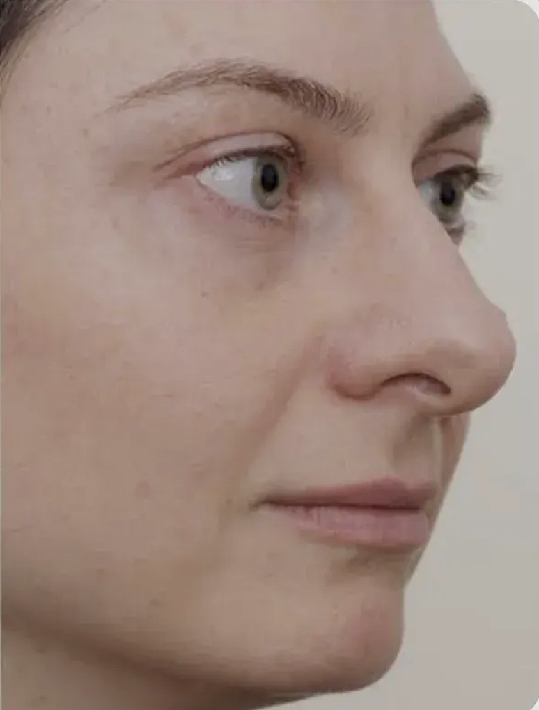 После