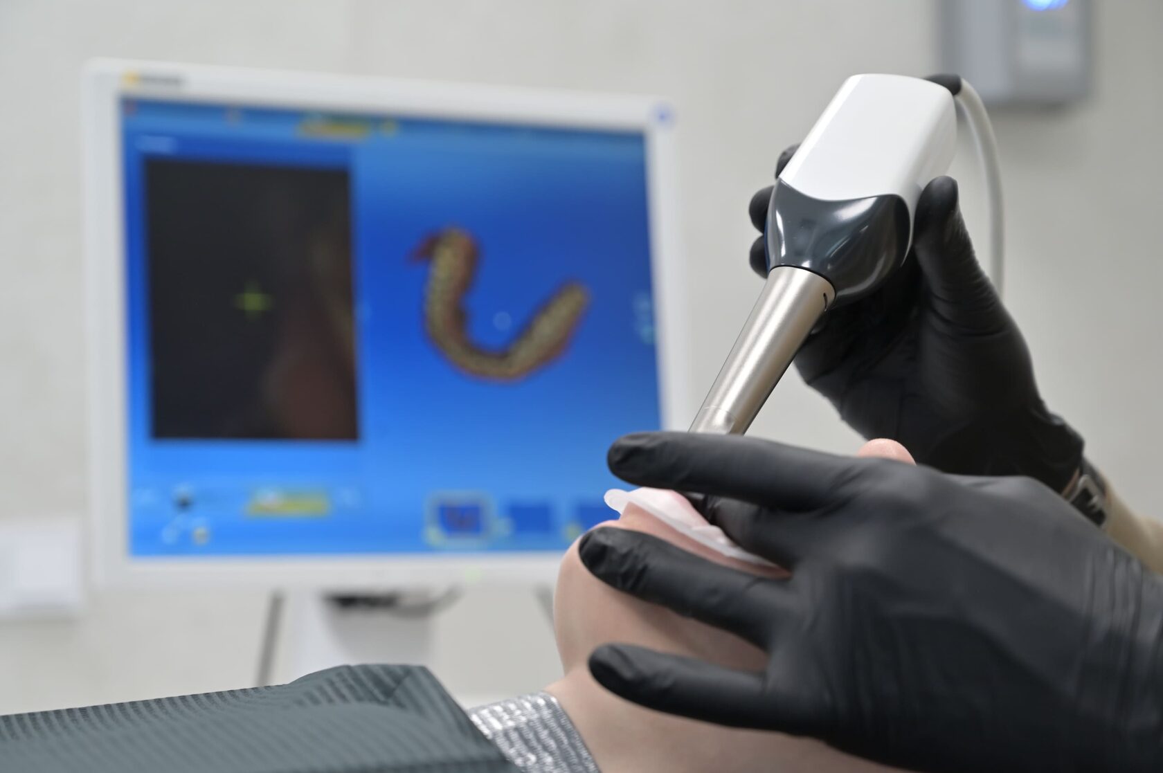 Лечение и реставрация зубов в стоматологической клинике Пробел