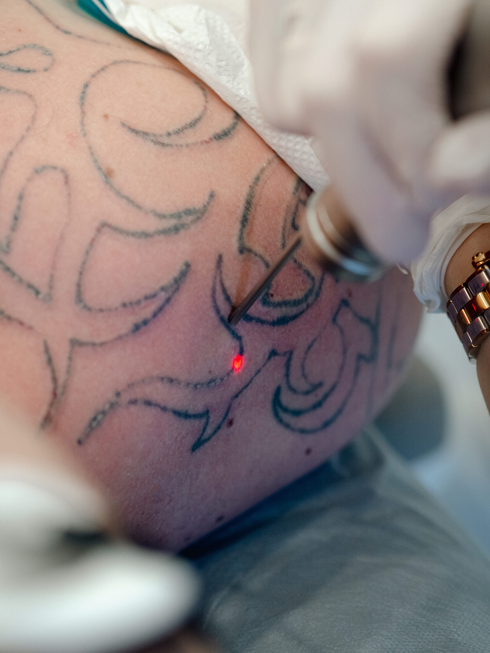 Карта боли тату: самые больные места под нанесение татуировки
