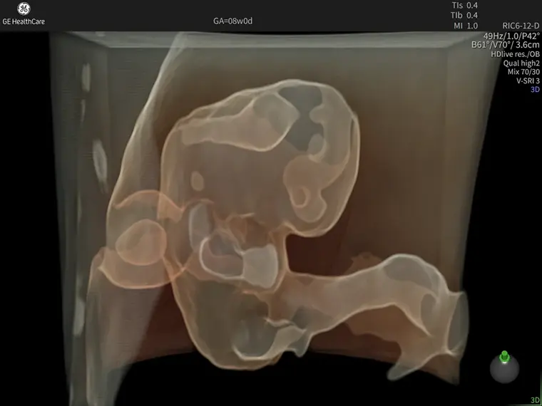 8-недельный эмбрион датчиком RIC6-12-D