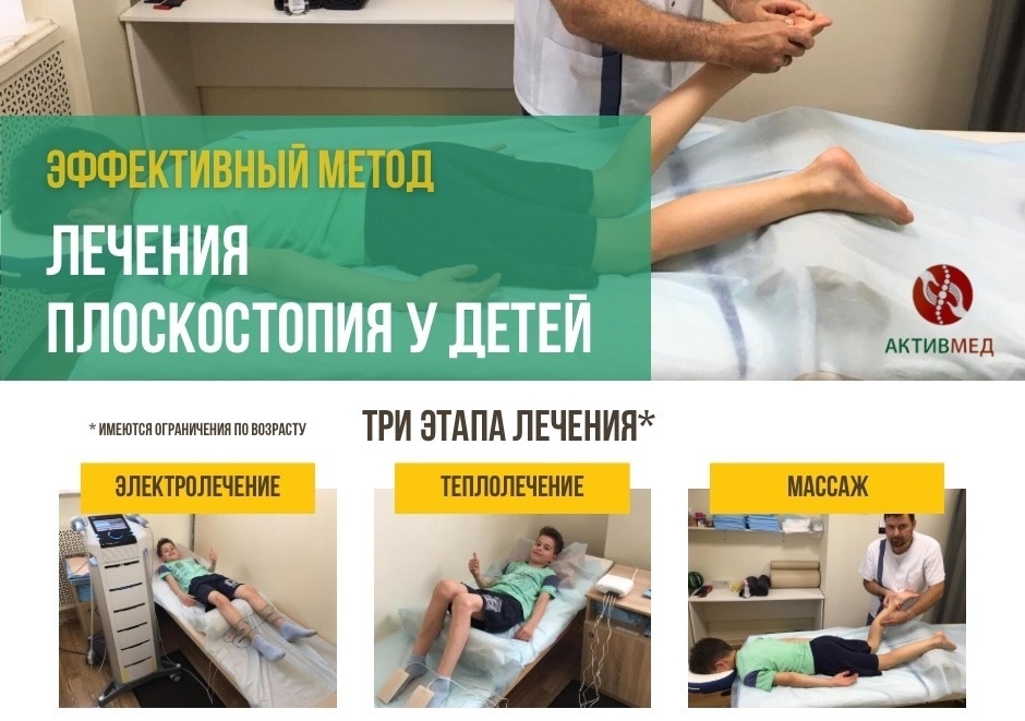 Лечение плоскостопия у детей