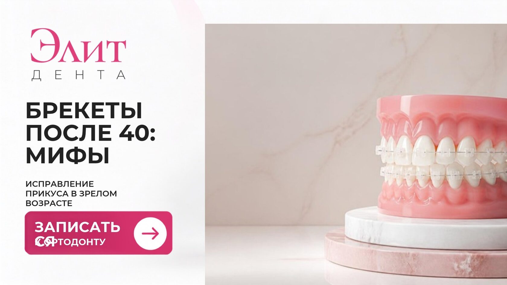 Брекеты после 40: мифы и реальность
