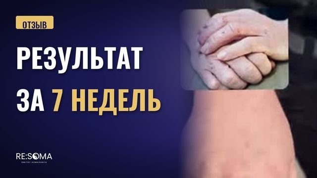 Видеоотзыв: дерматит: результат за 7 недель