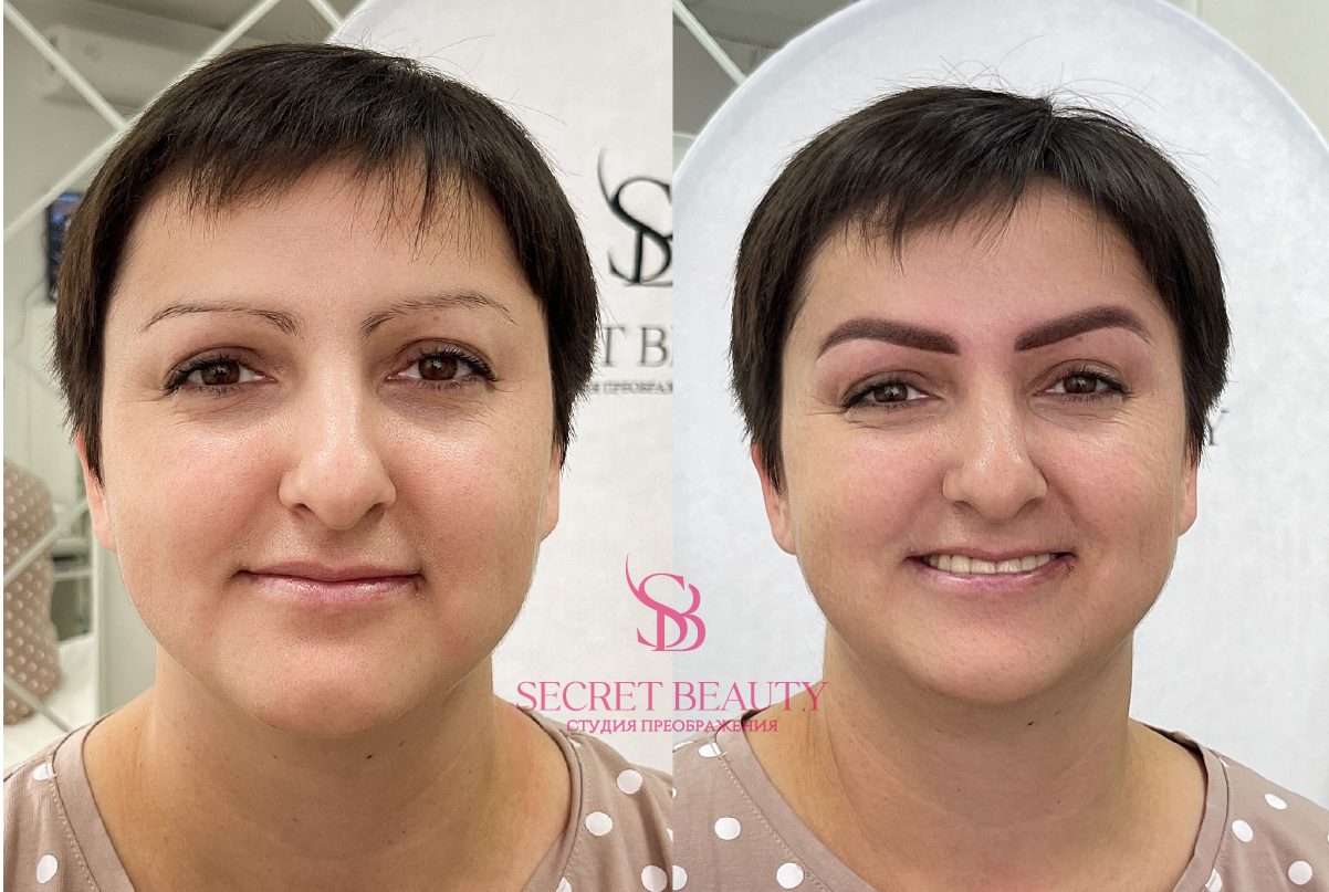 Фото лица до/после