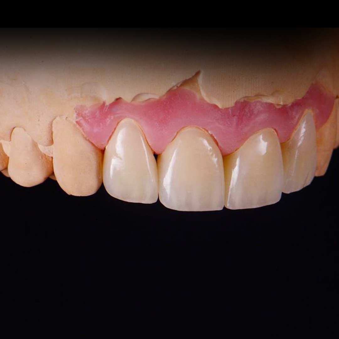 Зуботехническая лаборатория москва