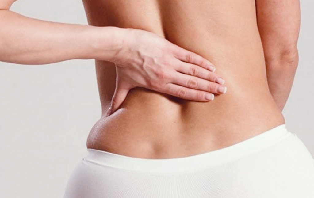 Пилонидальная киста с абсцессом