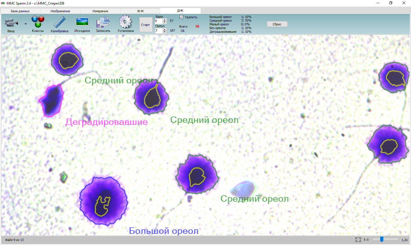 ММС Сперм (MMC Sperm) - автоматизированное программное обеспечение для  анализа качества спермы