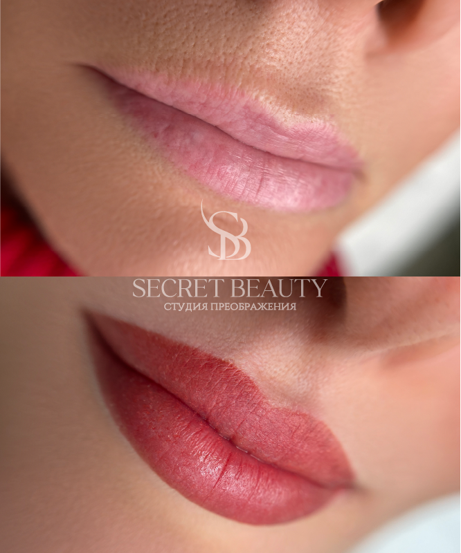 Фото губ до/после