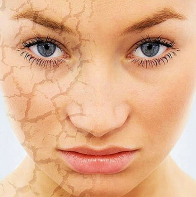 Как бороться с сухой и обезвоженной кожей лица?