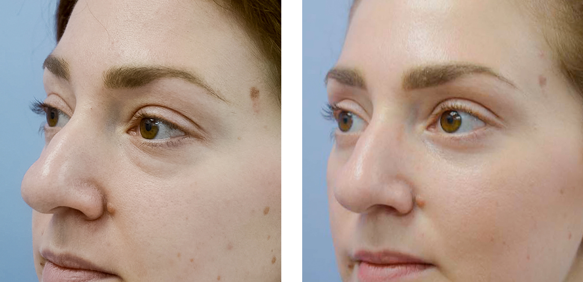 тумаков отзывы