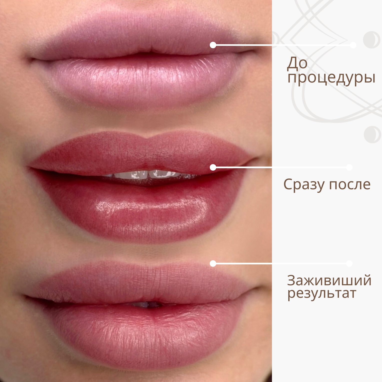 перманентный макияж губ до после фото