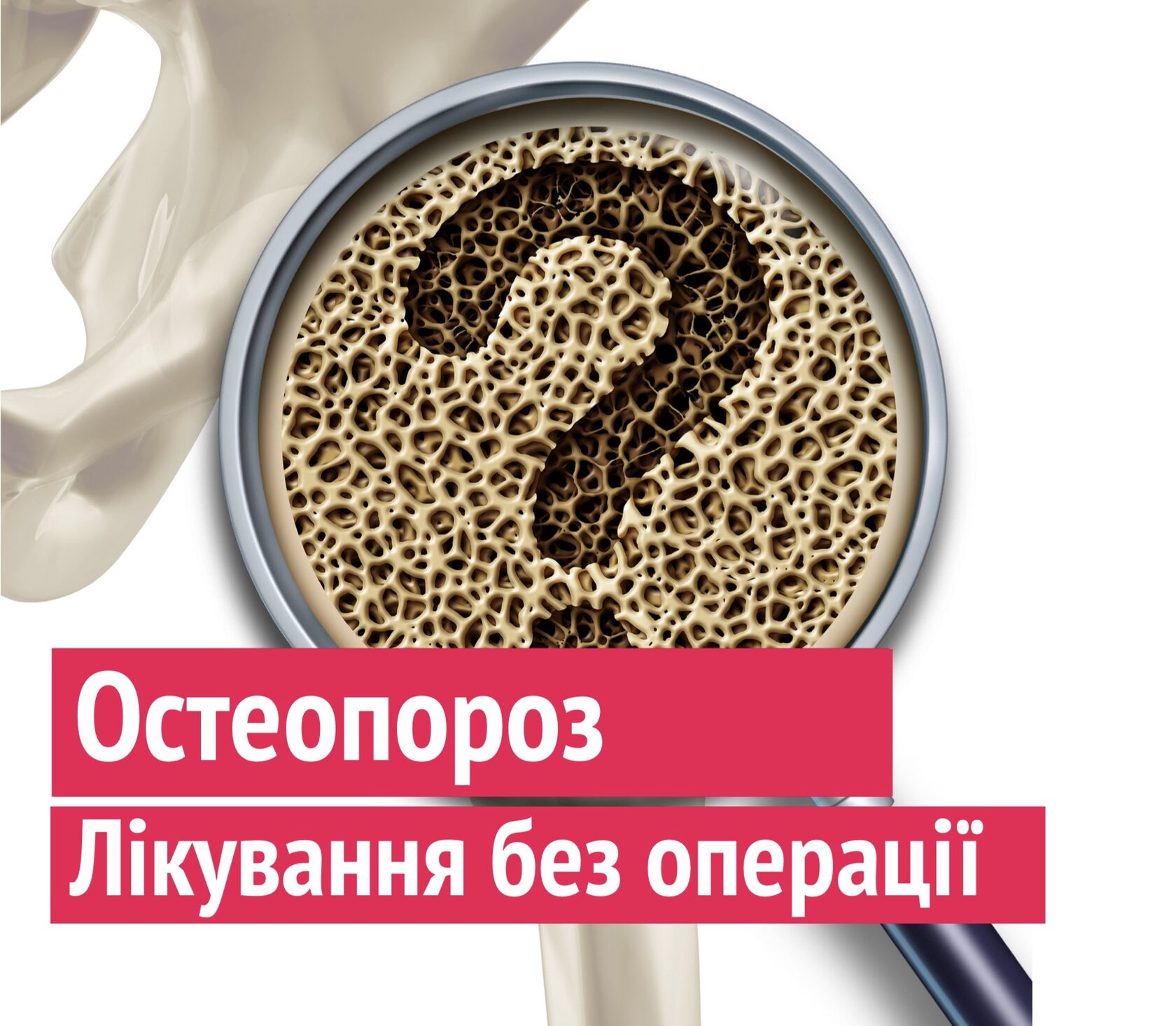 Какой стол при остеопорозе