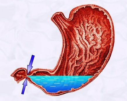 Свойства ионизированной воды в желудке