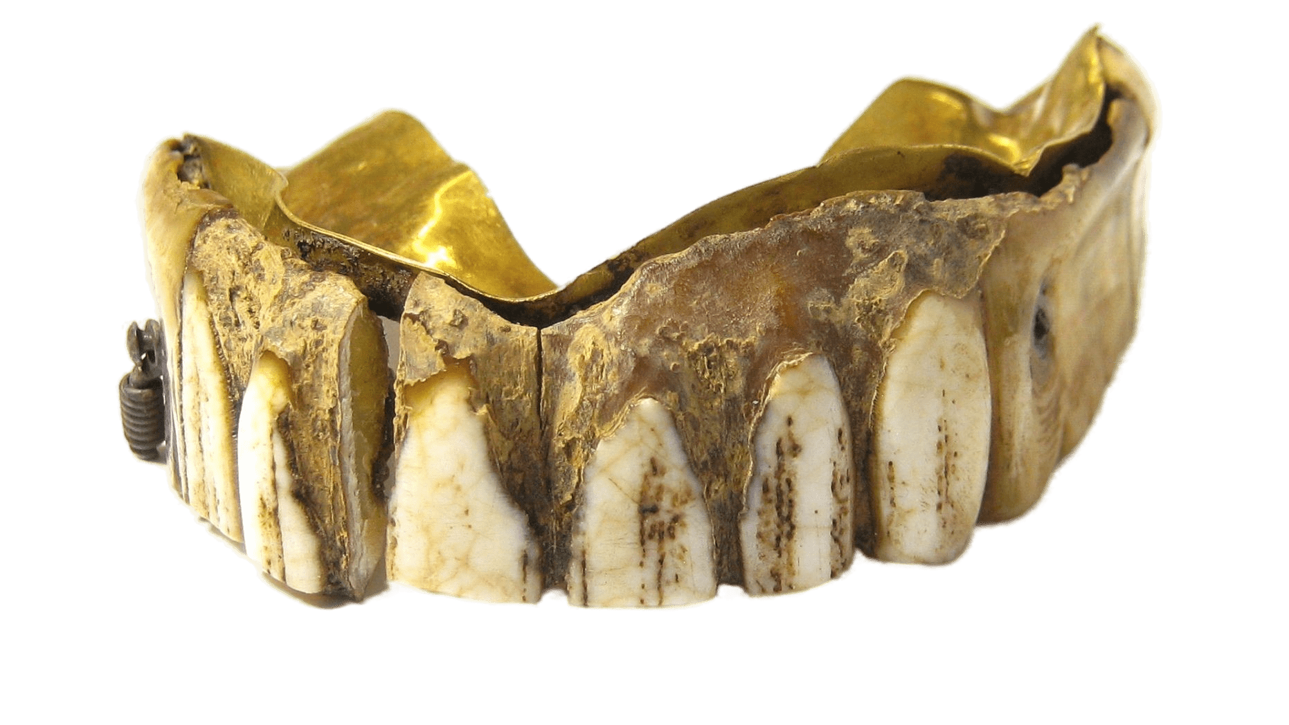 древний протез зубов