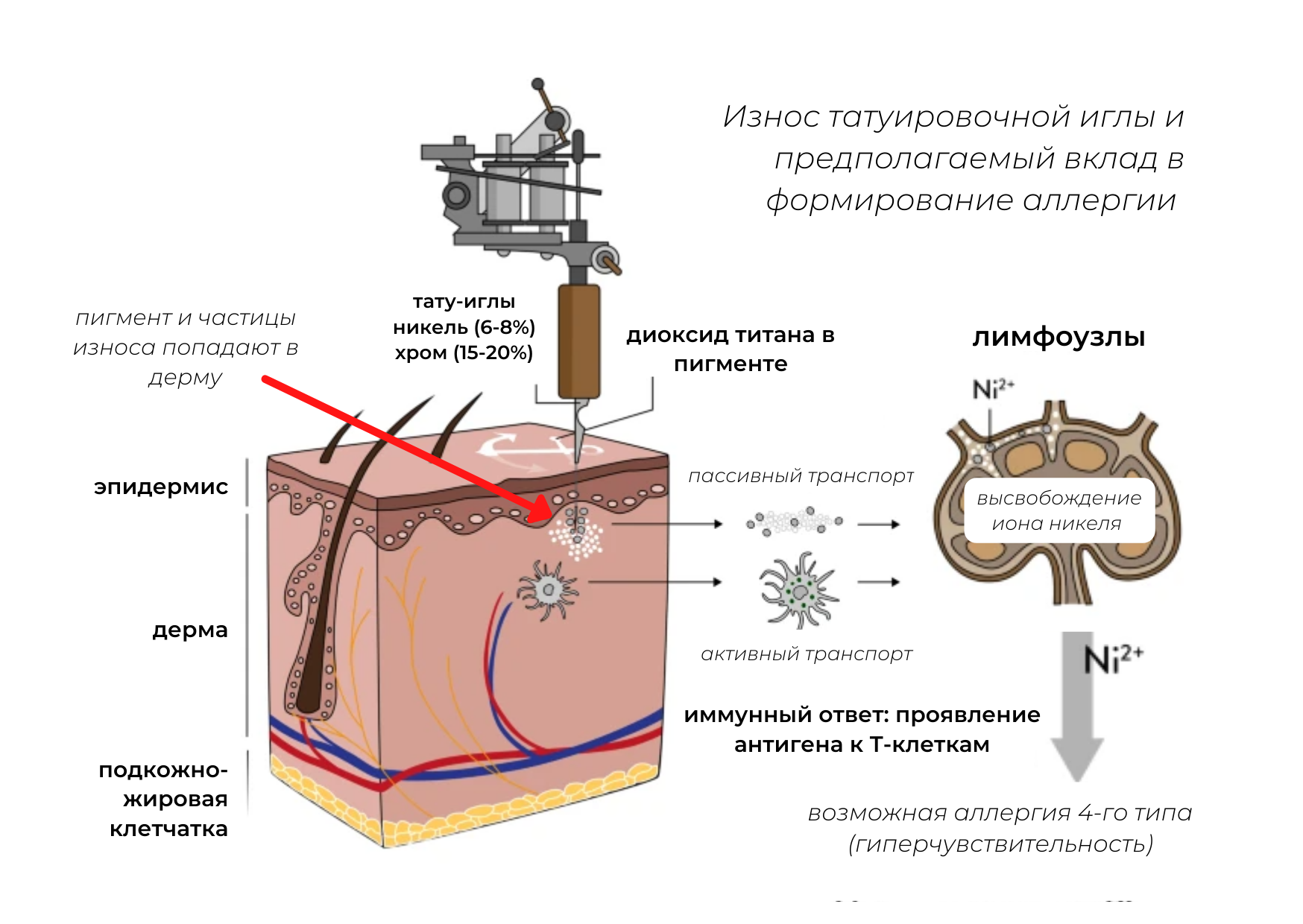 Тату-иглы вызывают аллергию! Правда или миф?