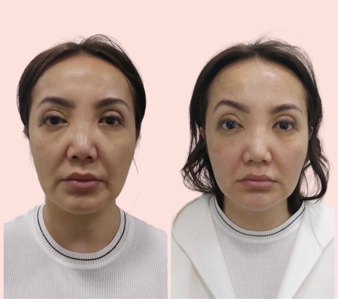There are free windows for recording for face massage. CALL AND RECORD. The pric