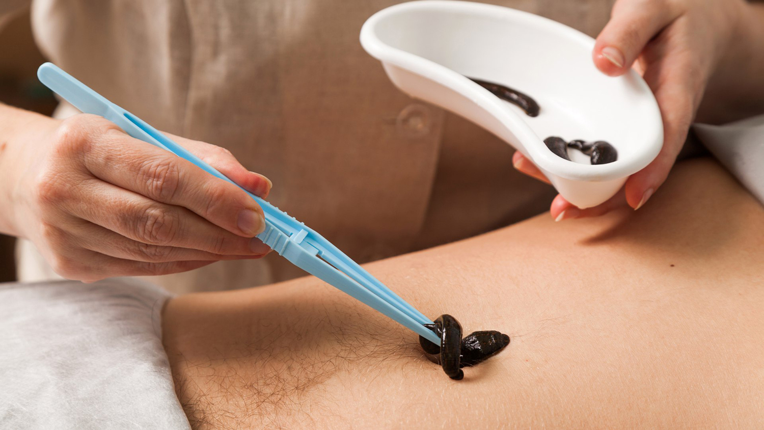 Процедура простая. Решение — медицинское.